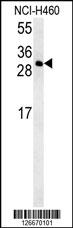 CCDC69 Antibody (Center) (Cat.#AP5466c) western blot analysis in NCI-H460 cell line lysates (35ug/lane).This demonstrates the CCDC69 antibody detected the CCDC69 protein (arrow).