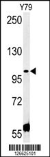 CCDC146 Antibody (N-term) (Cat.#AP5462a) western blot analysis in Y79 cell line lysates (35ug/lane).This demonstrates the CCDC146 antibody detected the CCDC146 protein (arrow).