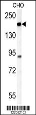 ATP11C Antibody (Center) (Cat.#AP5446c) western blot analysis in CHO cell line lysates (35ug/lane).This demonstrates the ATP11C antibody detected the ATP11C protein (arrow).
