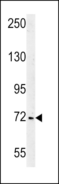 SHCBP1 Antibody (C-term)(Cat. #AP5433b) western blot analysis in Jurkat cell line lysates (35ug/lane).This demonstrates the SHCBP1 antibody detected the SHCBP1 protein (arrow).