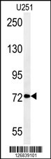 DEPDC1 Antibody (N-term)(Cat. #AP5428a) western blot analysis in U251 cell line lysates (35ug/lane).This demonstrates the DEPDC1 antibody detected the DEPDC1 protein (arrow).