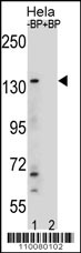 Western blot analysis of anti-JMJD3 Center Pab (AP1022c) in Hela cell line lysates. JMJD3 Center(arrow) was detected using the purified Pab.