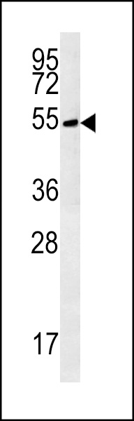 TRMT11 Antibody (C-term)(Cat. #AP5390b) western blot analysis in Hela cell line lysates (35ug/lane).This demonstrates the TRMT11 antibody detected the TRMT11 protein (arrow).