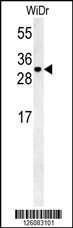 TM2D3 Antibody (N-term)(Cat. #AP5366a) western blot analysis in WiDr cell line lysates (35ug/lane).This demonstrates the TM2D3 antibody detected the TM2D3 protein (arrow).
