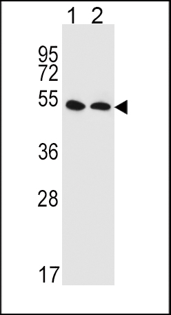 SLC47A1 Antibody (C-term) (Cat. #AP5354b) western blot analysis in HepG2(lane 1),MDA-MB435(lane 2) cell line lysates (35ug/lane).This demonstrates the SLC47A1 antibody detected the SLC47A1 protein (arrow).
