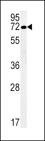 SLC19A3 Antibody (Center) (Cat. #AP5345c) western blot analysis in NCI-H292 cell line lysates (35ug/lane).This demonstrates the SLC19A3 antibody detected the SLC19A3 protein (arrow).