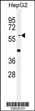 Western blot analysis of YLAT2 Antibody (C-term) (Cat. #AP5300b) in HepG2 cell line lysates (35ug/lane).YLAT2 (arrow) was detected using the purified Pab.