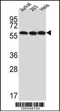 Western blot analysis of UTP6 Antibody (N-term) (Cat. #AP5296a) in Jurkat,293,Hela cell line lysates (35ug/lane).UTP6 (arrow) was detected using the purified Pab.