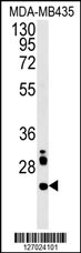 LHPL3 Antibody (C-term) (Cat. #AP5721b) western blot analysis in MDA-MB435 cell line lysates (15ug/lane).This demonstrates the LHPL3 antibody detected the LHPL3 protein (arrow).