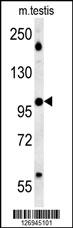BRWD2 Antibody (Center) (Cat. #AP5715c) western blot analysis in mouse testis tissue lysates (15ug/lane).This demonstrates the BRWD2 antibody detected BRWD2 protein (arrow).