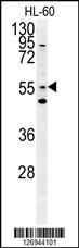 LMA1L Antibody (Center) (Cat. #AP5714c) western blot analysis in HL-60 cell line lysates (15ug/lane).This demonstrates the LMA1L antibody detected the LMA1L protein (arrow).
