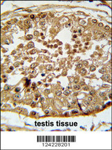 SPAG1 Antibody (N-term) (Cat. #AP5699a) immunohistochemistry analysis in formalin fixed and paraffin embedded human testis tissue followed by peroxidase conjugation of the secondary antibody and DAB staining. This data demonstrates the use of the SPAG1 Antibody (N-term) for immunohistochemistry. Clinical relevance has not been evaluated.