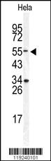 Western blot analysis of DONSON Antibody (Center) (Cat. #AP5661c) in Hela cell line lysates (35ug/lane). DONSON (arrow) was detected using the purified Pab.