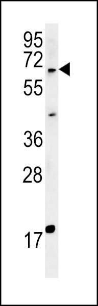 MKRN3 Antibody (Center) (Cat. #AP5648c) western blot analysis in MDA-MB435cell line lysates (15ug/lane).This demonstrates the MKRN3 antibody detected the MKRN3 protein (arrow).