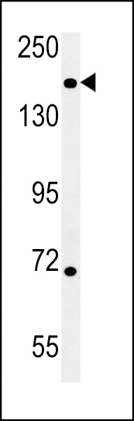 DI3L1 Antibody (N-term) (Cat. #AP5614a) western blot analysis in mouse heart tissue lysates (15ug/lane).This demonstrates the DI3L1 antibody detected DI3L1 protein (arrow).