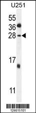 GGTLC2 Antibody (Center) (Cat. #AP10216c) western blot analysis in U251 cell line lysates (35ug/lane).This demonstrates the GGTLC2 antibody detected the GGTLC2 protein (arrow).