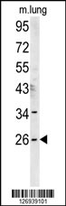 DNJC8 Antibody (C-term) (Cat. #AP5576b) western blot analysis in mouse lung tissue lysates (15ug/lane).This demonstrates the DNJC8 antibody detected DNJC8 protein (arrow).
