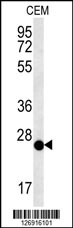 CRISPLD2 Antibody (N-term) (Cat. #AP5570a) western blot analysis in CEM cell line lysates (15ug/lane).This demonstrates the CRISPLD2 antibody detected the CRISPLD2 protein (arrow).