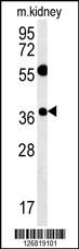 TSPAN3 Antibody (Center) (Cat. #AP5559c) western blot analysis in mouse kidney tissue lysates (15ug/lane).This demonstrates the TSPAN3 antibody detected TSPAN3 protein (arrow).