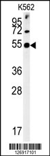 SYT13 Antibody (N-term) (Cat.#AP5482a) western blot analysis in K562 cell line lysates (35ug/lane).This demonstrates the SYT13 antibody detected the SYT13 protein (arrow).
