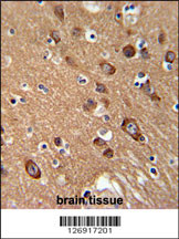 SYT13 Antibody (N-term) (Cat. #AP5482a) immunohistochemistry analysis in formalin fixed and paraffin embedded human brain tissue followed by peroxidase conjugation of the secondary antibody and DAB staining. This data demonstrates the use of the SYT13 Antibody (N-term) for immunohistochemistry. Clinical relevance has not been evaluated.