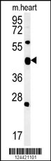 ACSF3 Antibody (Center) (Cat. #AP5910c) western blot analysis in mouse heart tissue lysates (15ug/lane).This demonstrates the ACSF3 antibody detected ACSF3 protein (arrow).