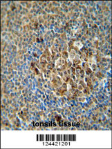 ACSF3 antibody (Center) (Cat. #AP5910c) immunohistochemistry analysis in formalin fixed and paraffin embedded human tonsils tissue followed by peroxidase conjugation of the secondary antibody and DAB staining. This data demonstrates the use of the ACSF3 antibody (Center) for immunohistochemistry. Clinical relevance has not been evaluated.