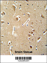 CILP2 antibody (Center) (Cat. #AP5907c) immunohistochemistry analysis in formalin fixed and paraffin embedded human brain tissue followed by peroxidase conjugation of the secondary antibody and DAB staining. This data demonstrates the use of the CILP2 antibody (Center) for immunohistochemistry. Clinical relevance has not been evaluated.