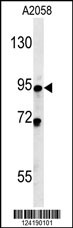 SMPD4 Antibody (N-term) (Cat. #AP5904a) western blot analysis in A2058 cell line lysates (35ug/lane).This demonstrates the SMPD4 antibody detected the SMPD4 protein (arrow).