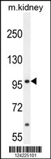 MED25 Antibody (N-term) (Cat. #AP10203a) western blot analysis in mouse kidney tissue lysates (35ug/lane).This demonstrates the MED25 antibody detected the MED25 protein (arrow).