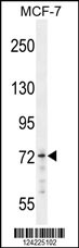 MED25 Antibody (N-term) ((Cat. #AP10203a) western blot analysis in MCF-7 cell line lysates (35ug/lane).This demonstrates the MED25 antibody detected the MED25 protein (arrow).