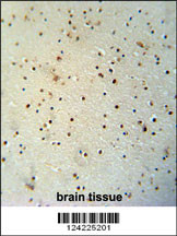 MED25 antibody (N-term) (Cat. #AP10203a) immunohistochemistry analysis in formalin fixed and paraffin embedded human brain tissue followed by peroxidase conjugation of the secondary antibody and DAB staining. This data demonstrates the use of the MED25 antibody (N-term) for immunohistochemistry. Clinical relevance has not been evaluated.