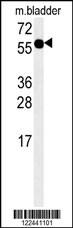 ADSSL1 Antibody (N-term) (Cat. #AP5873a) western blot analysis in mouse bladder tissue lysates (15ug/lane).This demonstrates the ADSSL1 antibody detected ADSSL1 protein (arrow).