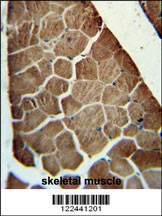 ADSSL1 antibody (N-term) (Cat. #AP5873a) immunohistochemistry analysis in formalin fixed and paraffin embedded human skeletal muscle followed by peroxidase conjugation of the secondary antibody and DAB staining. This data demonstrates the use of the ADSSL1 antibody (N-term) for immunohistochemistry. Clinical relevance has not been evaluated.