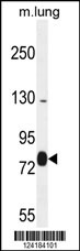 EXOC8 Antibody (Center) (Cat. #AP10202c) western blot analysis in mouse lung tissue lysates (35ug/lane).This demonstrates the EXOC8 antibody detected the EXOC8 protein (arrow).