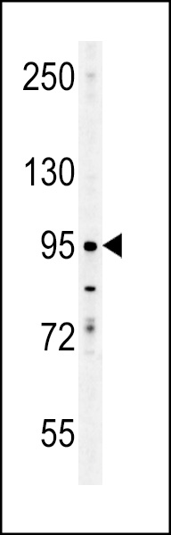 ENAM Antibody (C-term) (Cat. #AP5838b) western blot analysis in K562 cell line lysates (35ug/lane).This demonstrates the ENAM antibody detected the ENAM protein (arrow).