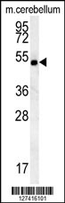 hCG_2039146 Antibody (Center) (Cat. #AP5815c) western blot analysis in mouse cerebellum tissue lysates (15ug/lane).This demonstrates the CG_2039146 antibody detected CG_2039146 protein (arrow).