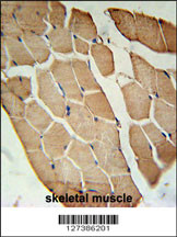OLFML2A Antibody (N-term) (Cat. #AP5808a) immunohistochemistry analysis in formalin fixed and paraffin embedded human skeletal muscle followed by peroxidase conjugation of the secondary antibody and DAB staining. This data demonstrates the use of the OLFML2A Antibody (N-term) for immunohistochemistry. Clinical relevance has not been evaluated.