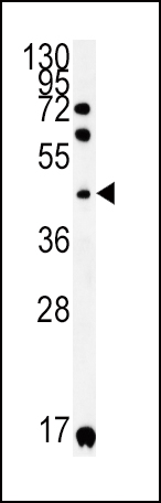 KIR2DS2 Antibody (Center) (Cat. #AP5764c) western blot analysis in A2058 cell line lysates (35ug/lane).This demonstrates the KIR2DS2 antibody detected the KIR2DS2 protein (arrow).