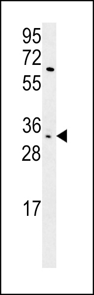KIR2DS3 Antibody (C-term) (Cat. #AP5763b) western blot analysis in HL-60 cell line lysates (15ug/lane).This demonstrates the KIR2DS3 antibody detected the KIR2DS3 protein (arrow).