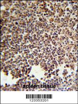 KIR2DS3 Antibody (C-term) (Cat. #AP5763b) immunohistochemistry analysis in formalin fixed and paraffin embedded human spleen tissue followed by peroxidase conjugation of the secondary antibody and DAB staining. This data demonstrates the use of the KIR2DS3 Antibody (C-term) for immunohistochemistry. Clinical relevance has not been evaluated.