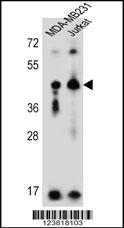 KIR2DL2 Antibody (C-Term) (Cat. #AP5762d) western blot analysis in MDA-MB231,Jurkat cell line lysates (35ug/lane).This demonstrates the KIR2DL2 antibody detected the KIR2DL2 protein (arrow).