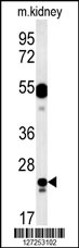 LYSMD1 Antibody (C-term) (Cat. #AP5745b) western blot analysis in mouse kidney tissue lysates (15ug/lane).This demonstrates the LYSMD1 antibody detected LYSMD1 protein (arrow).