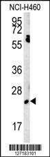EBPL Antibody (C-term) (Cat. #AP5735b) western blot analysis in NCI-H460 cell line lysates (15ug/lane).This demonstrates the EBPL antibody detected the EBPL protein (arrow).