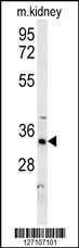 DHB13 Antibody (N-term) (Cat. #AP5729a) western blot analysis in mouse kidney tissue lysates (15ug/lane).This demonstrates the DHB13 antibody detected DHB13 protein (arrow).