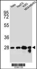 CHPT1 Antibody (N-term) (Cat. #AP10186a) western blot analysis in Hela,HepG2,K562,MDA-MB453 cell line lysates (35ug/lane).This demonstrates the CHPT1 antibody detected the CHPT1 protein (arrow).