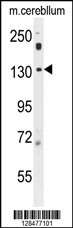 POTEF Antibody (Center) (Cat. #AP10631c) western blot analysis in mouse cerebellum tissue lysates (35ug/lane).This demonstrates the POTEF antibody detected the POTEF protein (arrow).