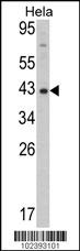 Western blot analysis of Mouse Dnmt3L Antibody (Cat. #AP1062a) in Hela cell line lysates (35ug/lane). Dnmt3l (arrow) was detected using the purified Pab.