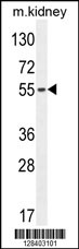 FBXO39 Antibody (C-term) (Cat. #AP10627b) western blot analysis in mouse kidney tissue lysates (35ug/lane).This demonstrates the FBXO39 antibody detected the FBXO39 protein (arrow).