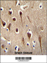 FBXO39 Antibody (C-term) (Cat. #AP10627b) immunohistochemistry analysis in formalin fixed and paraffin embedded human brain tissue followed by peroxidase conjugation of the secondary antibody and DAB staining. This data demonstrates the use of the FBXO39 Antibody (C-term) for immunohistochemistry. Clinical relevance has not been evaluated.